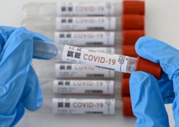 A partir de febrero no permitirán importaciones pruebas rápidas de COVID, sin Registro Sanitario