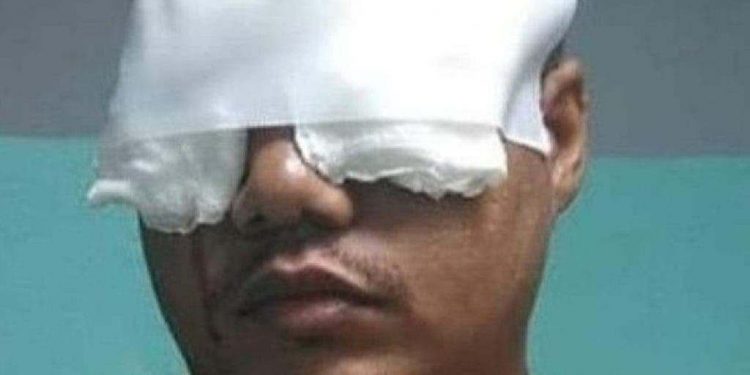 Asaltantes le perforaron los ojos con tijeras al hijo del locutor Raúl Mercedes