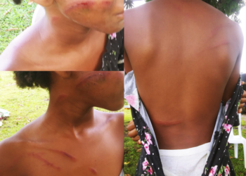 Activan búsqueda de hombre que propinó golpiza a sobrina de nueve años en Monte Plata