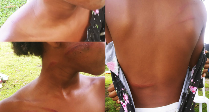 Activan búsqueda de hombre que propinó golpiza a sobrina de nueve años en Monte Plata