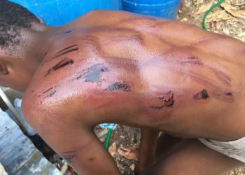 PN busca padre agredió severamente hijo menor en Montecristi