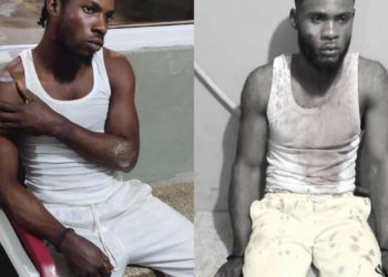 Por el amor de una mujer dos hombres se enfrentan a machetazos en Villa Riva