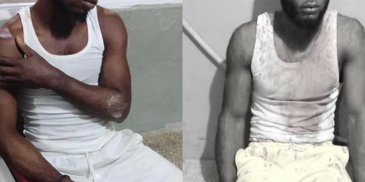 Por el amor de una mujer dos hombres se enfrentan a machetazos en Villa Riva