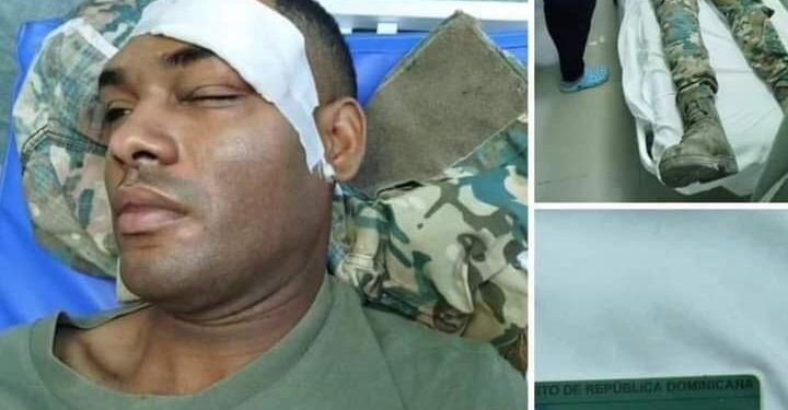 Haitiano le rompe la frente de una pedrada a un miembro del Ejército Nacional mientras trataba de detenerlo durante un operativo