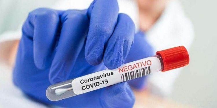 Francia impone la prueba PCR obligatoria para entrar en el país por avión