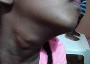 Familiares claman ayuda a las autoridades para salvar la vida de una niña con tumor