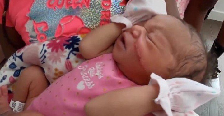 Recién nacido recibe 13 puntos de sutura tras sufrir corte en el rostro durante cesárea