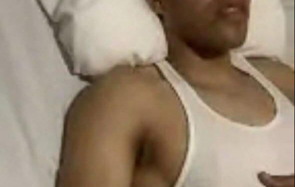 Cabo de la Policía Nacional pierde un ojo durante protesta en Bonao