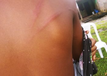 Hombre propina tremenda pela a niña de 9 años