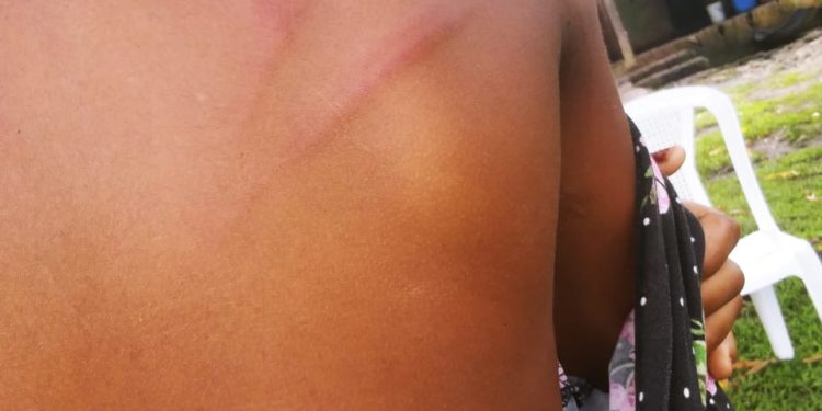 Hombre propina tremenda pela a niña de 9 años