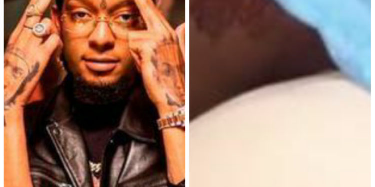 Emprenderán acciones legales contra equipo de trabajo de Rochy RD por agredir a un joven