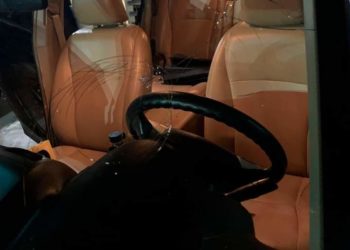 Joven salva su vida milagrosamente tras recibir un disparo en la cabeza durante asalto en SD