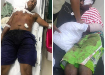 Por el amor de una mujer le cortan la mano a un hombre en Peralvillo, Monte Plata