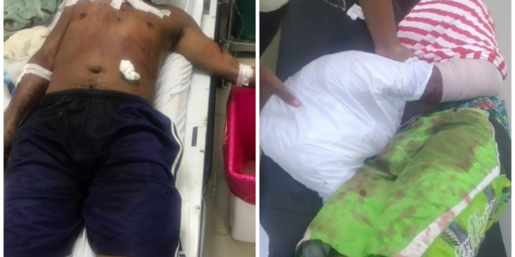 Por el amor de una mujer le cortan la mano a un hombre en Peralvillo, Monte Plata