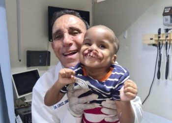 Fundación Cruz Jiminián ha operado 6,500 infantes con labio leporino y paladar hendido