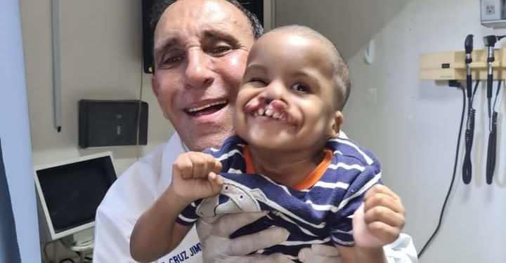 Fundación Cruz Jiminián ha operado 6,500 infantes con labio leporino y paladar hendido