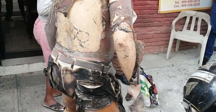 Video | Hombre se prende fuego en el palacio judicial de Ciudad Nueva en demanda de justicia