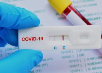 Gobierno autoriza se vendan pruebas covid-19 en farmacias