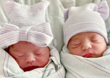 Nacen bebés mellizos en California en días, meses y años distintos