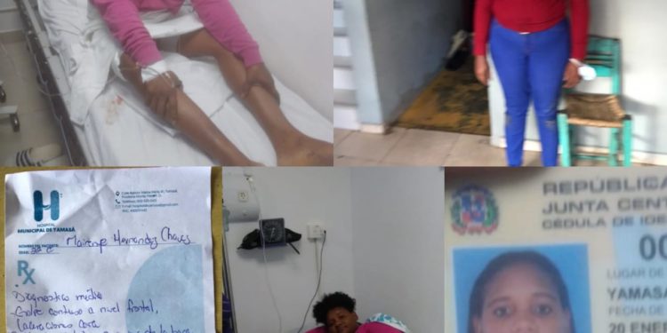 Miembro de la ARD hiere a otra mujer con arma de fuego supuestamente por celos en Yamasá