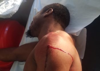 Hieren hombre de bala durante un atraco en Autovía del Nordeste