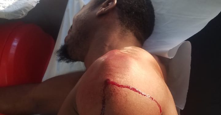 Hieren hombre de bala durante un atraco en Autovía del Nordeste