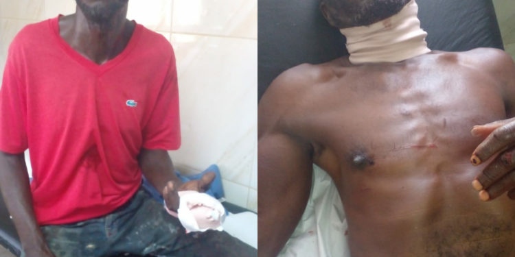 Hombres se hieren a machetazos por unos víveres en Gonzalo, Sabana Grande de Boyá