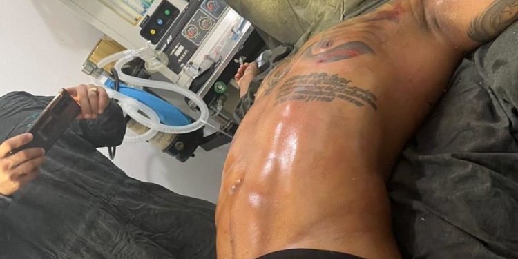 El Mayor Clásico dice que pocos urbanos admiten sus retoques tras someterse a una cirugía estética