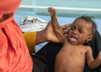 «Estamos en una cuenta regresiva hacia la catástrofe»: la ONU advierte del aumento de la hambruna en Yemen