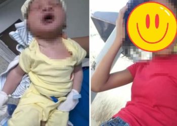 Intubada en cuidados intensivos, menor de 15 años de edad que dió a luz a infante de 9 libras