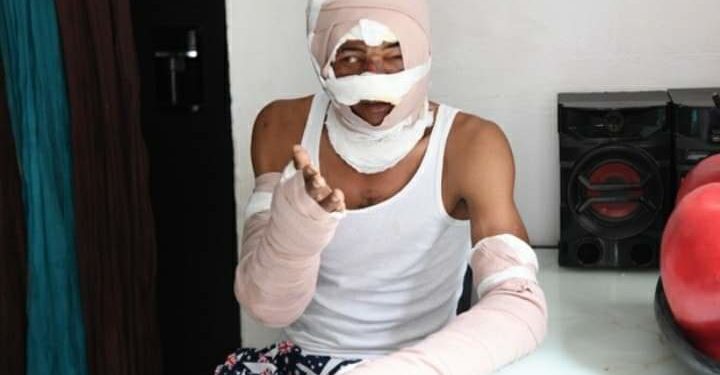 Conmovedor testimonio de hombre que sobrevivió a incendio del Canal del Sol