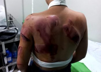 Mujer recibe atenciones médica luego de supuestamente ser golpeada por su pareja