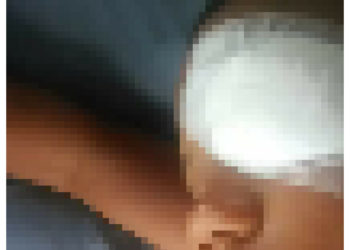 Niña de 11 años saca ojo a niño de 8 en escuela de Bonao