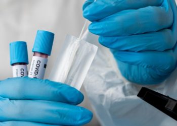 Salud Pública notifica 87 nuevos casos de covid-19 y cero defunciones en las últimas 24 horas