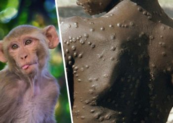 Antivirales podrían reducir la duración de los síntomas de viruela del mono