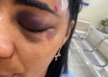 Conductor de camioneta choca dos mujeres y emprende la huida