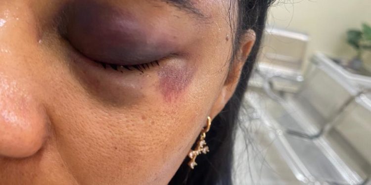 Conductor de camioneta choca dos mujeres y emprende la huida