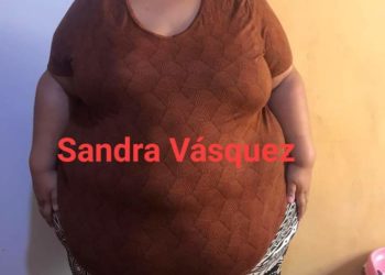 Joven pide ayuda para someterse a una cirugía para reducir el estómago