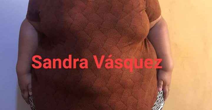 Joven pide ayuda para someterse a una cirugía para reducir el estómago