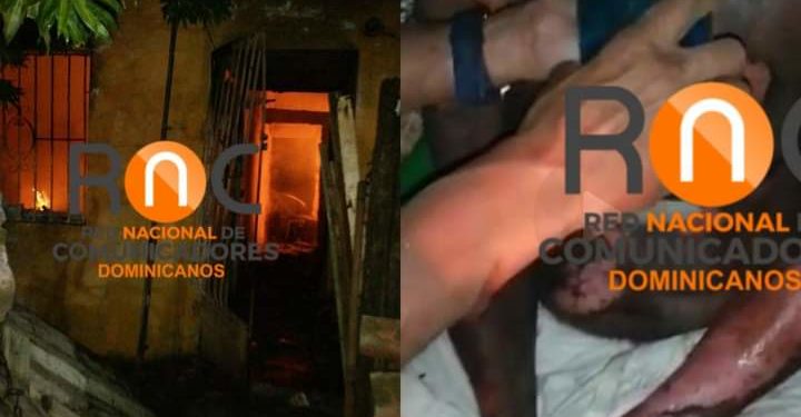 Sacan hombre de su casa con quemaduras en distintas partes del cuerpo tras incendiarse su vivienda en La Romana