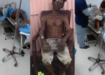 Mujer resulta afectada tras lanzar agua hirviendo a esposo por supuestos asuntos pasionales