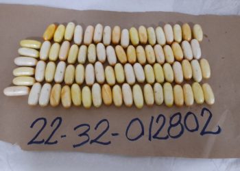 Arrestan extranjero con el estómago lleno de cocaína en el AILA; viajaría a Francia