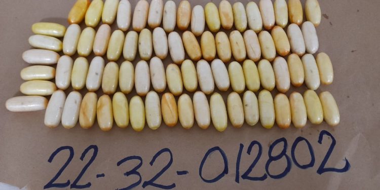 Arrestan extranjero con el estómago lleno de cocaína en el AILA; viajaría a Francia